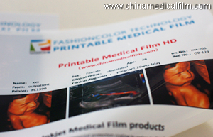 IMF180B Inkjet Medical Film blue finish 180um